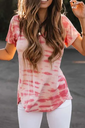 Chicindress Loosetie Tie-Dry Top